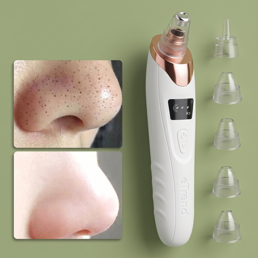 5-in-1 Blackhead Remover